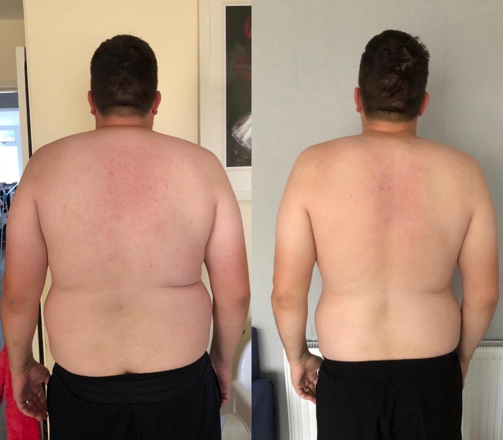 Pete before and after
